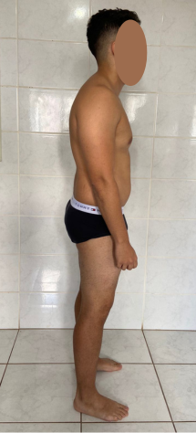 Antes