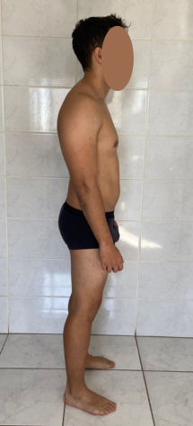 Depois