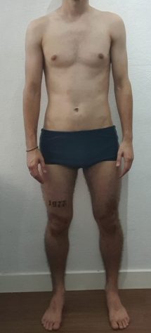 imagem-antes